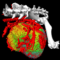 The Physics of Cancer